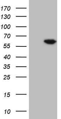 FLT1 / VEGFR1 Antibody (aa781-1338, clone OTI11G5)
