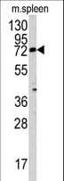 IHC-plus™ Polyclonal Rabbit anti-Human GNT-III / MGAT3 Antibody (aa72-102, IHC, WB)