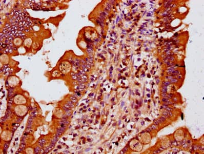 Polyclonal Rabbit anti-Human MTSS1 / MIM Antibody (IHC, WB)