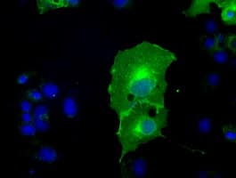 Monoclonal Mouse anti-Human L1CAM Antibody (clone OTI2C7, IHC, IF, WB)