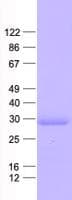 Human PPT1 / CLN1 Protein (Recombinant His, N-Terminal)