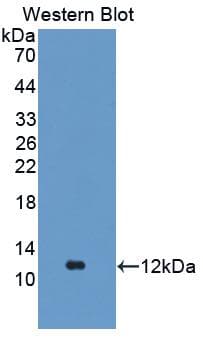 FGA / Fibrinogen Alpha Antibody