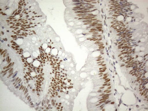 Monoclonal Mouse anti-Human CWC27 Antibody (clone OTI4C8, aa145-472, IHC, WB)
