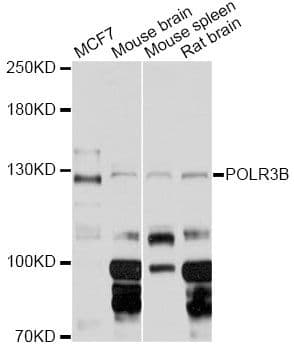 POLR3B Antibody