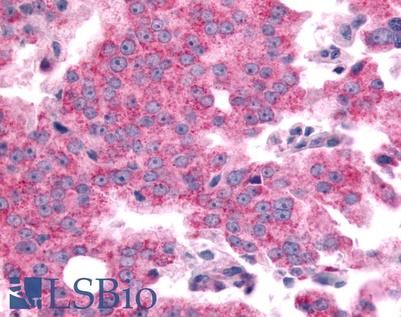 PathPlus™ SGK2 Antibody (Internal)