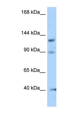 OFD1 Antibody (N-Terminus)