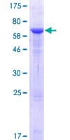 Human VPS26B Protein (Recombinant GST)