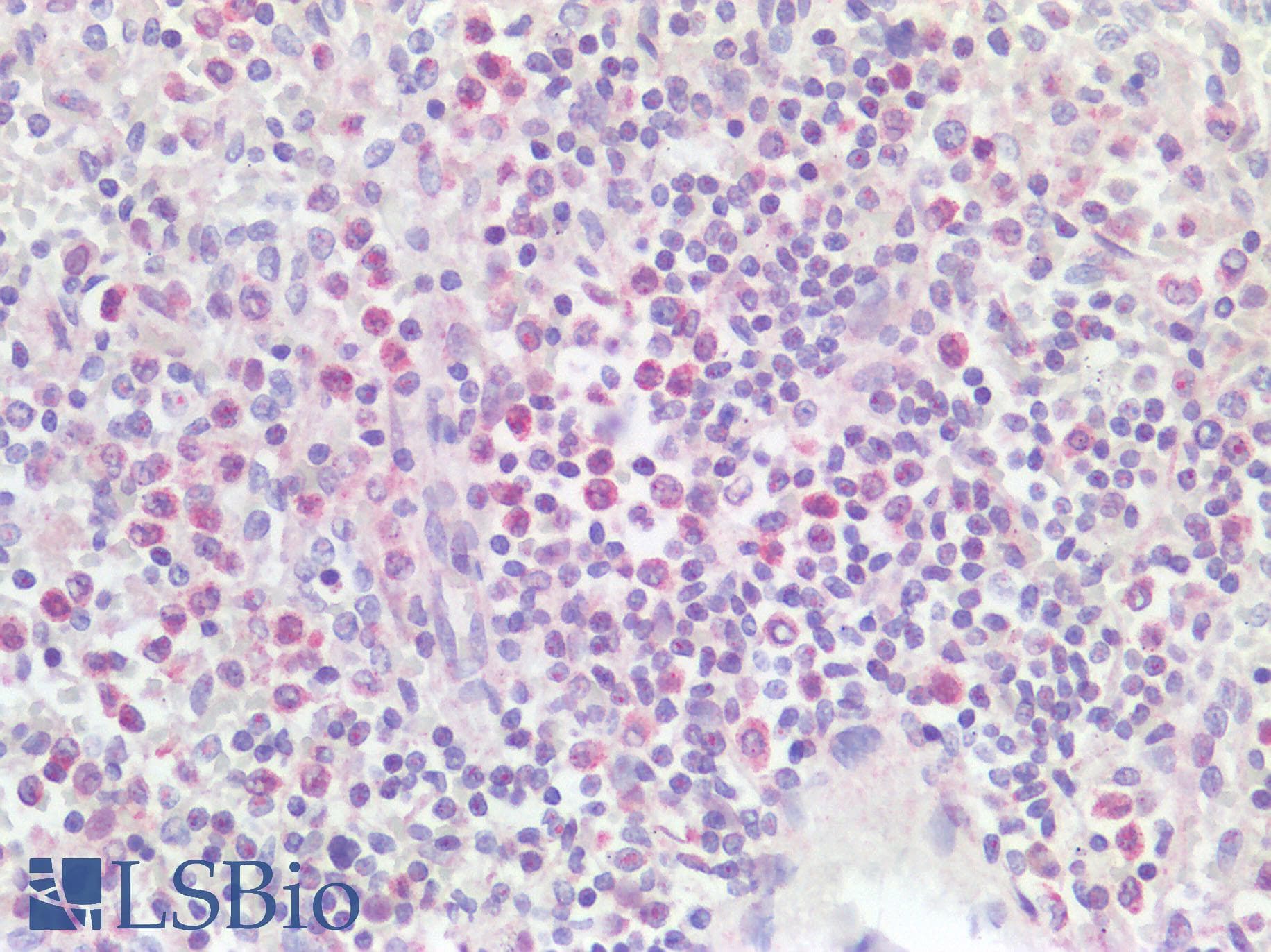 LILRA1 / LIR6 Antibody (aa53-102)