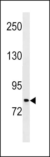 PLOD2 Antibody (aa483-512)