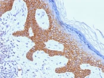 DSG3 / Desmoglein 3 Antibody (clone DSG3/1535)