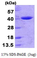 E. coli Beta Lactamase Protein (Recombinant His)