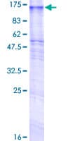 Human GPR155 Protein (Recombinant GST)