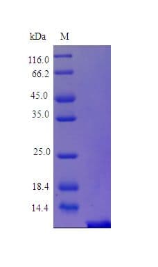 Human PTH / Parathyroid Hormone Protein (Recombinant)