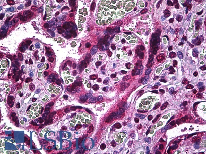 IHC-plus™ Monoclonal Mouse anti-Human MAP2K3 / MEK3 / MKK3 Antibody (clone 1D10, IHC, WB)