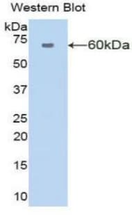 AMY1A / Salivary Amylase Antibody (aa16-511)
