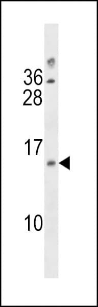 Polyclonal Rabbit anti-Human LIMS3 Antibody (aa28-54, WB)