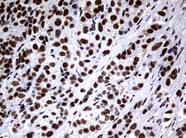 NBN / Nibrin Antibody (aa183-460, clone OTI2F5, Carrier-free)