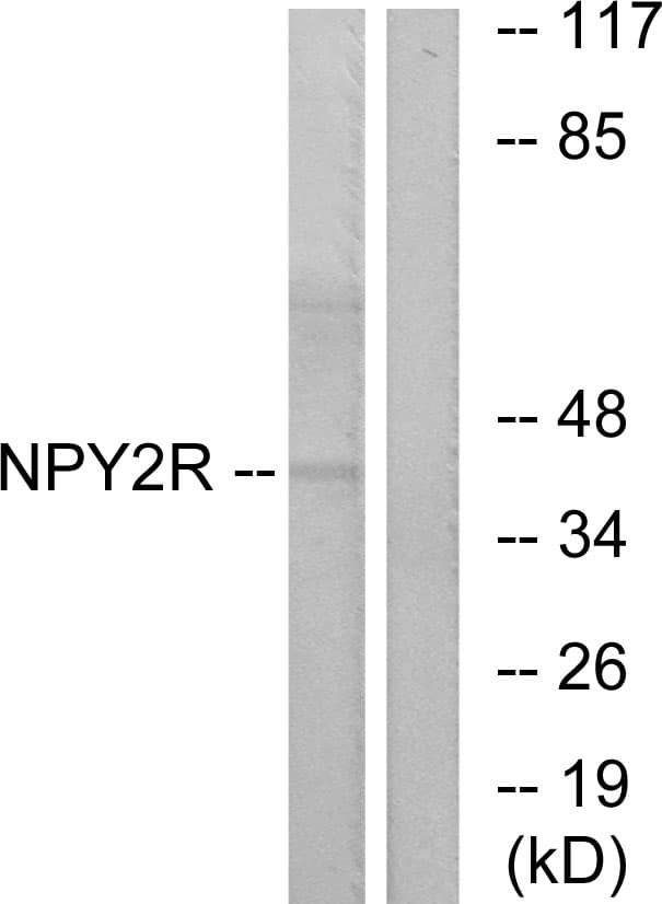 Polyclonal Rabbit anti-Human NPY2R Antibody (aa1-50, IF, WB)