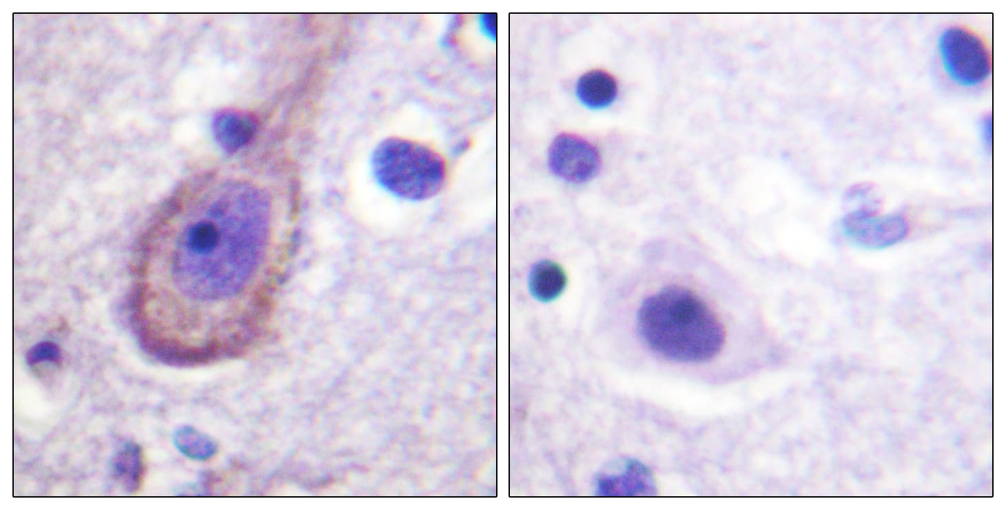 KCNQ3 Antibody (phospho-Thr246)