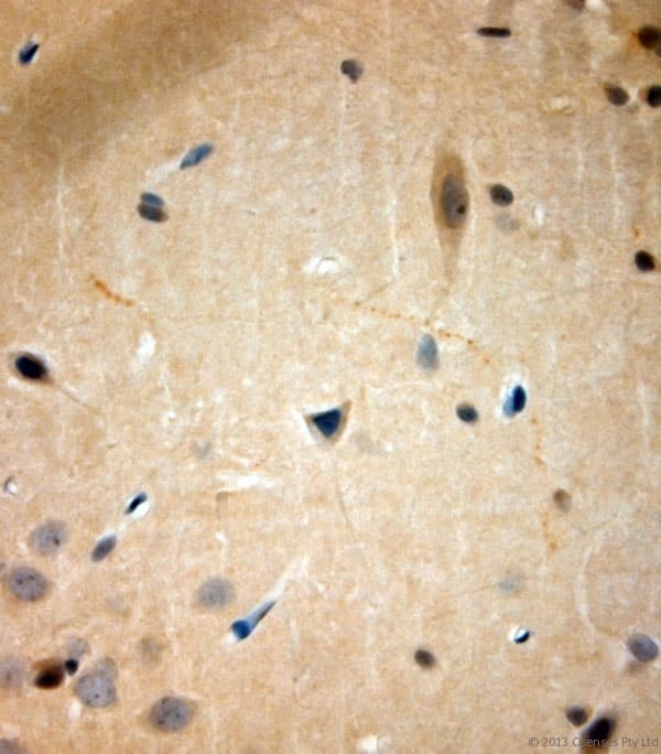 TACR1 / NK1R Antibody (aa150-200)