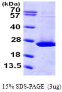 Human ARL1 Protein (Recombinant His)