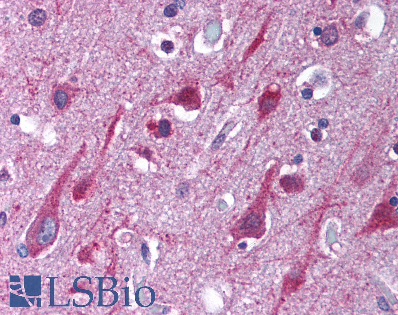IHC-plus™ PSEN1 / Presenilin 1 Antibody