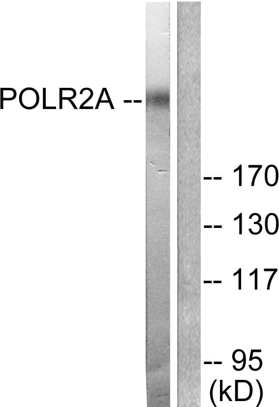 IHC-plus™ Polyclonal Rabbit anti-Human POLR2A / RNA polymerase II Antibody (aa1585-1634, IHC, IF, WB)