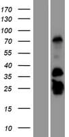 GCAP2 / GUCA1B Protein (Over-Expression Lysate Myc-DDK (Flag))