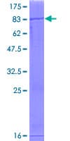 Human OXCT2 Protein (Recombinant GST)