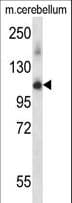 Polyclonal Rabbit anti-Mouse PRPF4B Antibody (aa180-207, WB)