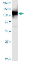 UBA1 / UBE1 Antibody (clone 2B6)