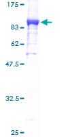 Human KARS Protein (Recombinant GST)