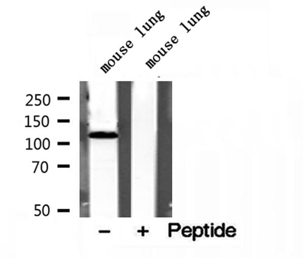 Polyclonal Rabbit anti-Human OGDH Antibody (IHC, WB)