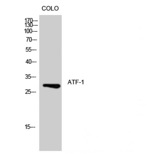 ATF1 Antibody (1-80 aa)