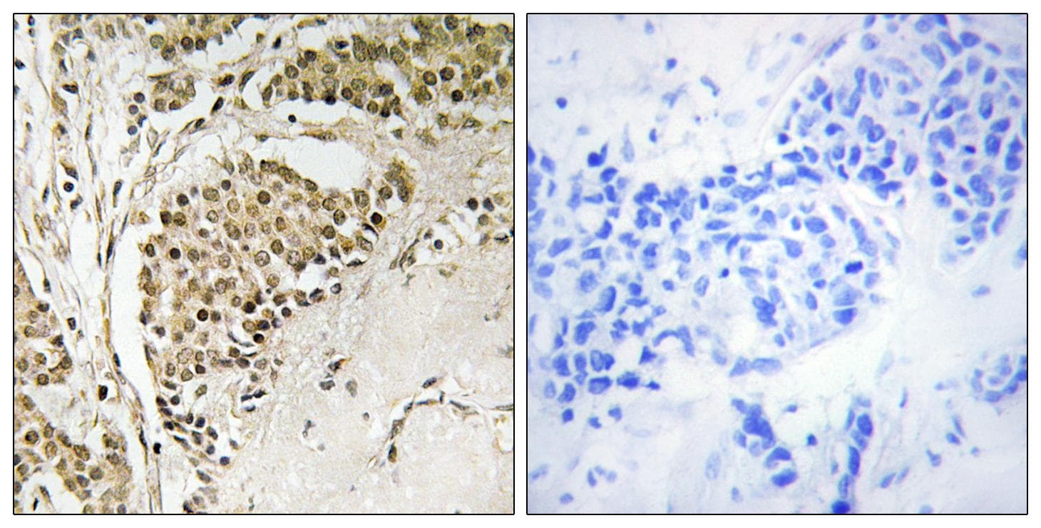 NOM1 Antibody