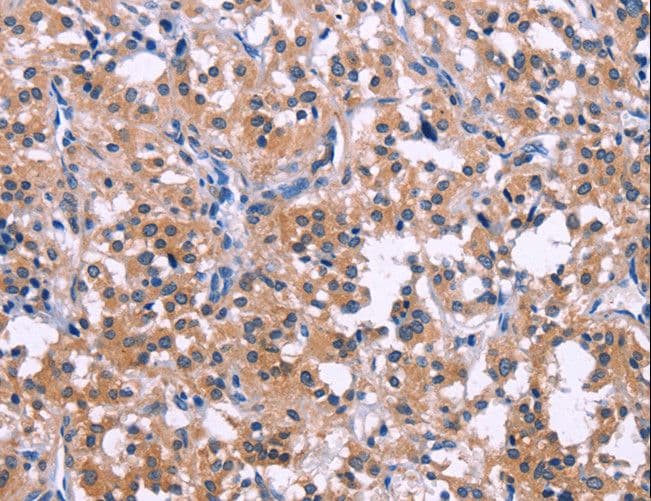 Polyclonal Rabbit anti-Human DUSP13 Antibody (IHC)