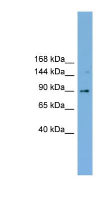 ERIC-1 / TACC3 Antibody (aa503-552)