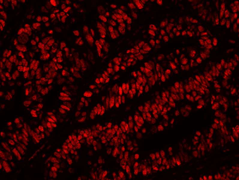 PathPlus™ MCM2 Antibody (aa1-50)