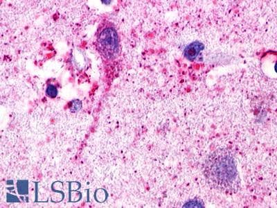 PathPlus™ Polyclonal Rabbit anti-Human RXFP1/ LGR7 Antibody (N-Terminus, IHC)
