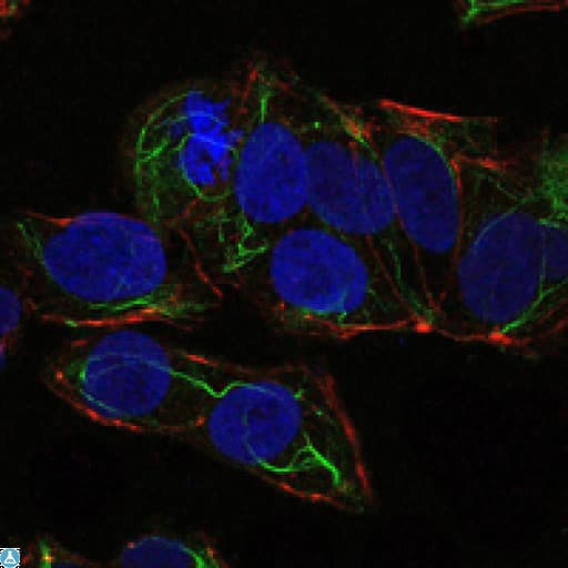 PRKAA1 / AMPK Alpha 1 Antibody