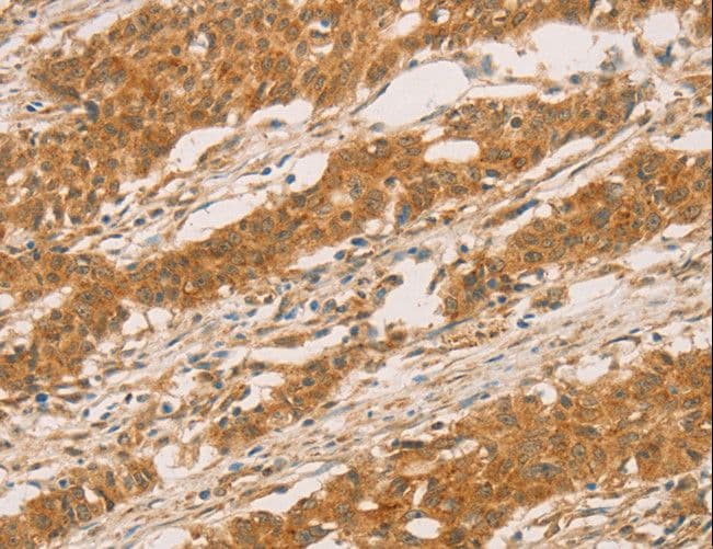 SLC6A3 / Dopamine Transporter Antibody