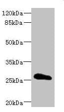 Polyclonal Rabbit anti-Human CLDN18 / Claudin 18 Antibody (IHC, WB)