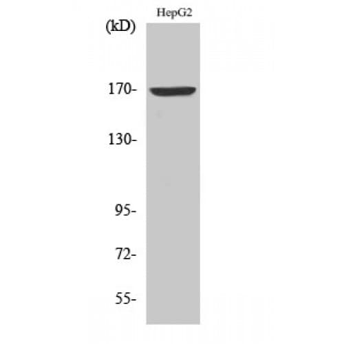 Polyclonal Rabbit anti-Human COL4A6 / Collagen IV Antibody (1170-1250 aa, C-terminal, IHC, IF, WB)