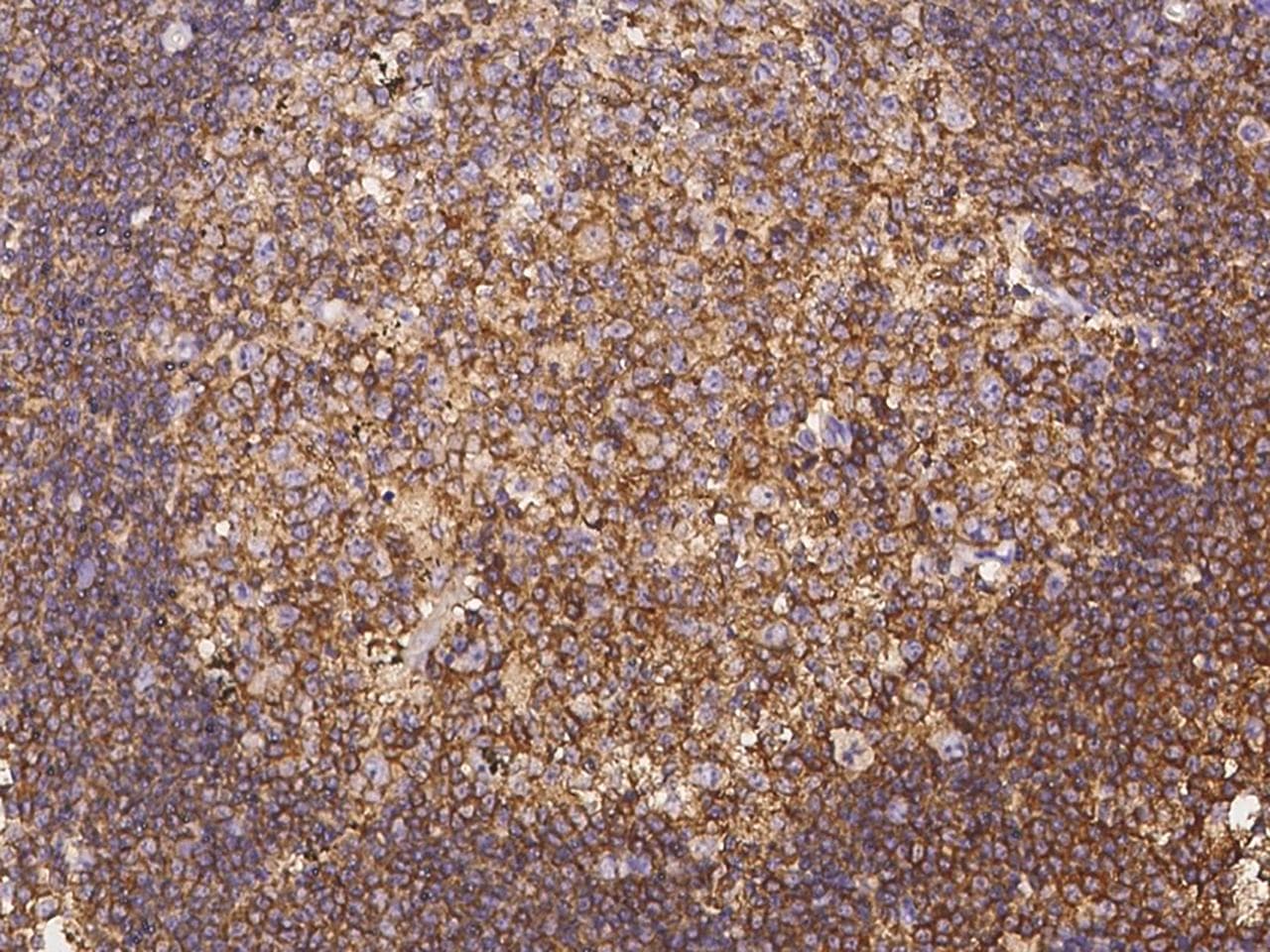 ARPC1B / p41-ARC / ARP2 Antibody