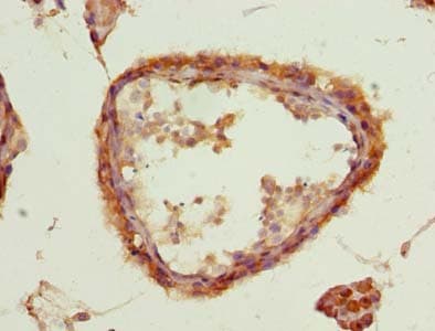 Polyclonal Rabbit anti-Human ACSBG2 Antibody (IHC, WB)