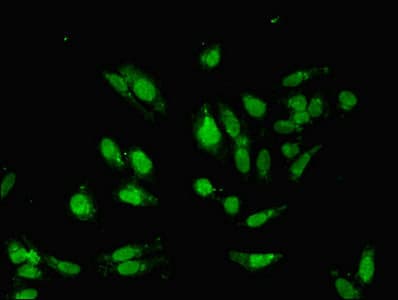 HDAC8 Antibody (aa1-377)