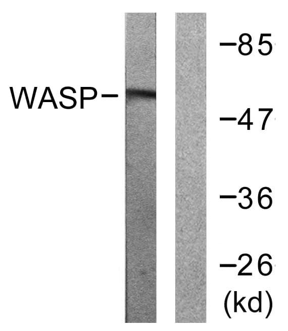WAS / WASP Antibody (aa256-305)