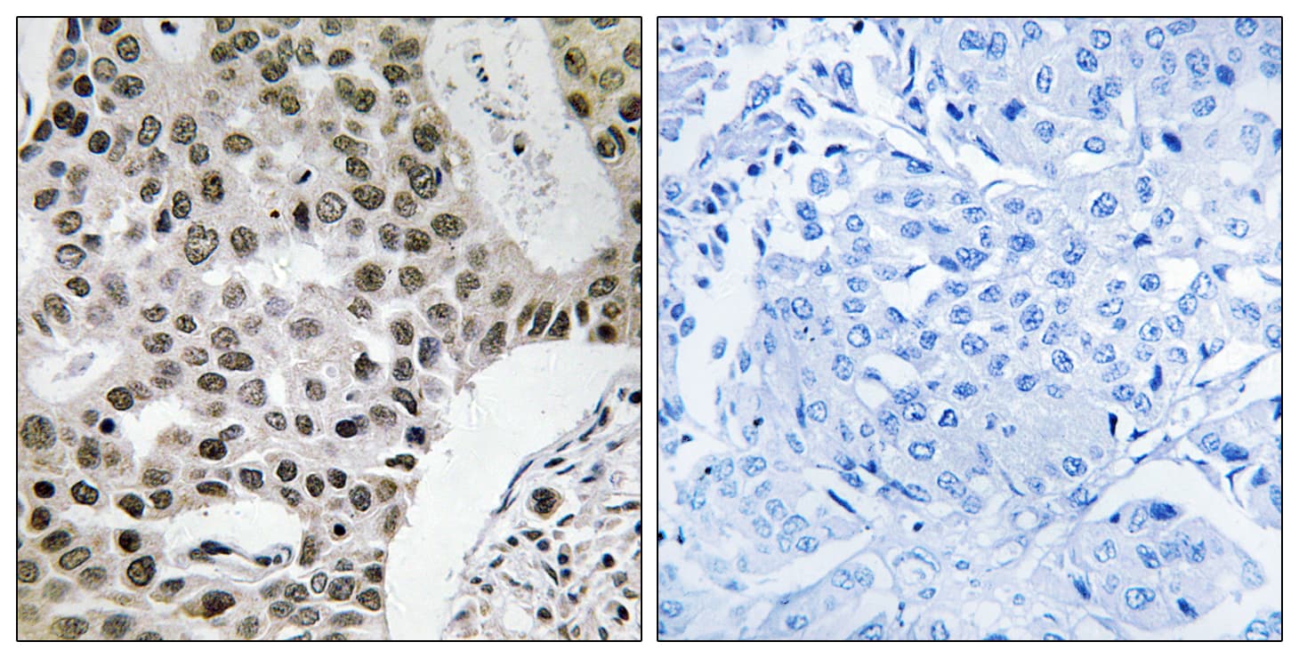ZMYM4 / ZNF262 Antibody (aa801-850)