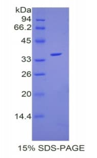 Mouse F5 / Factor Va Protein (Recombinant His)