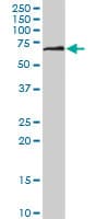 Monoclonal Mouse anti-Human DPYSL5 / CRMP5 Antibody (clone 2D10, WB)
